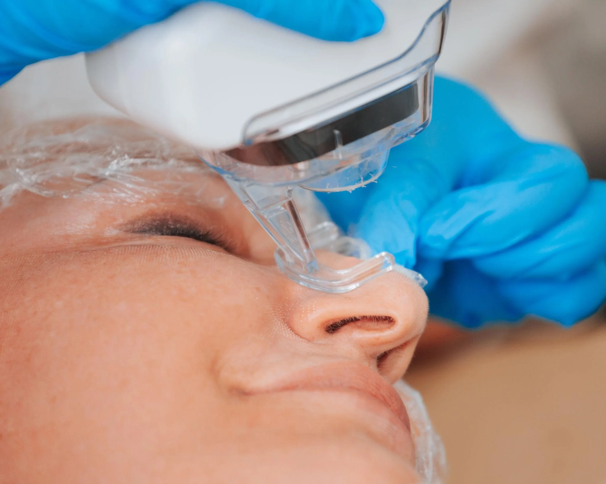 Patient with clear, renewed, and flawless skin