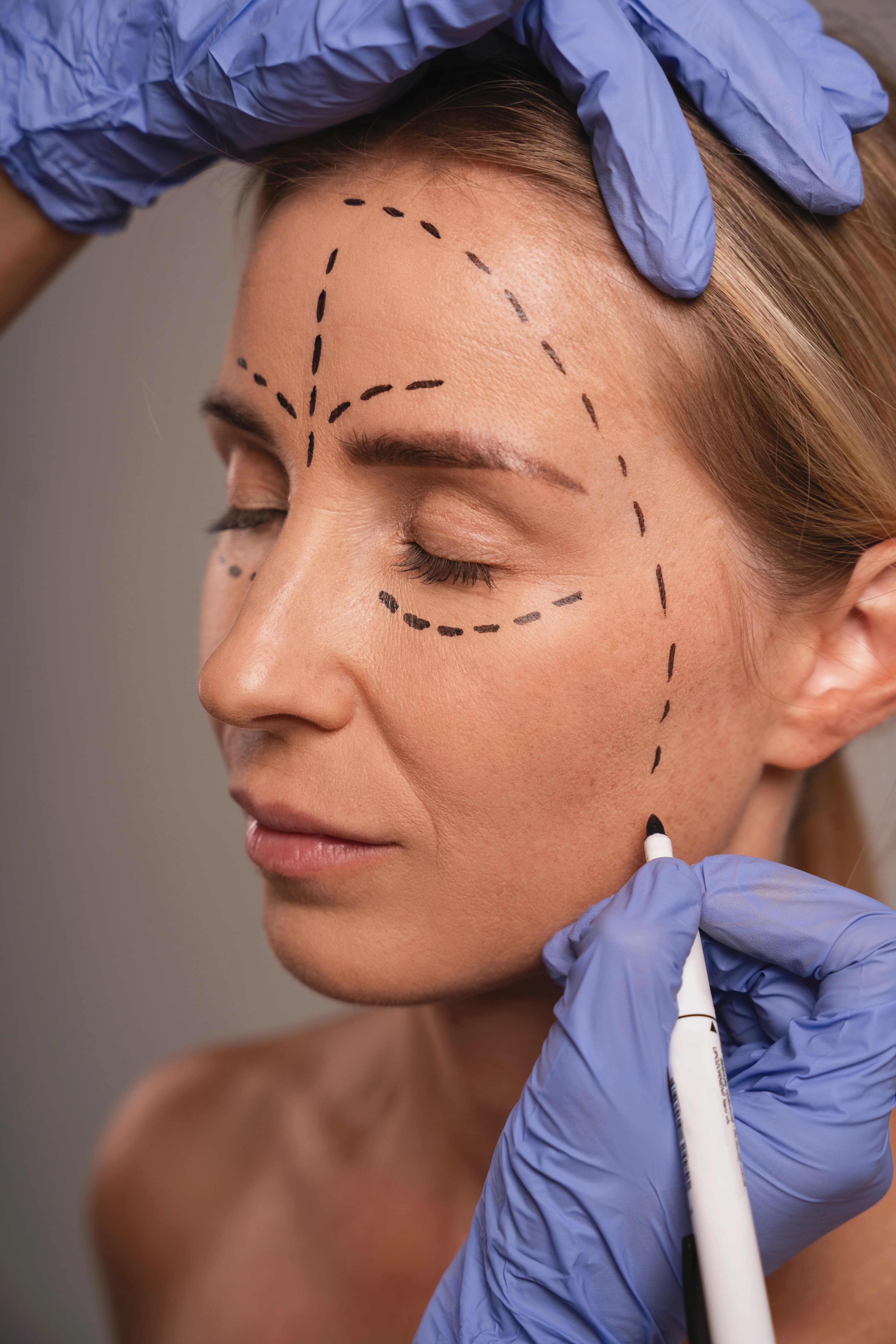 Patient with a perfectly contoured jawline
