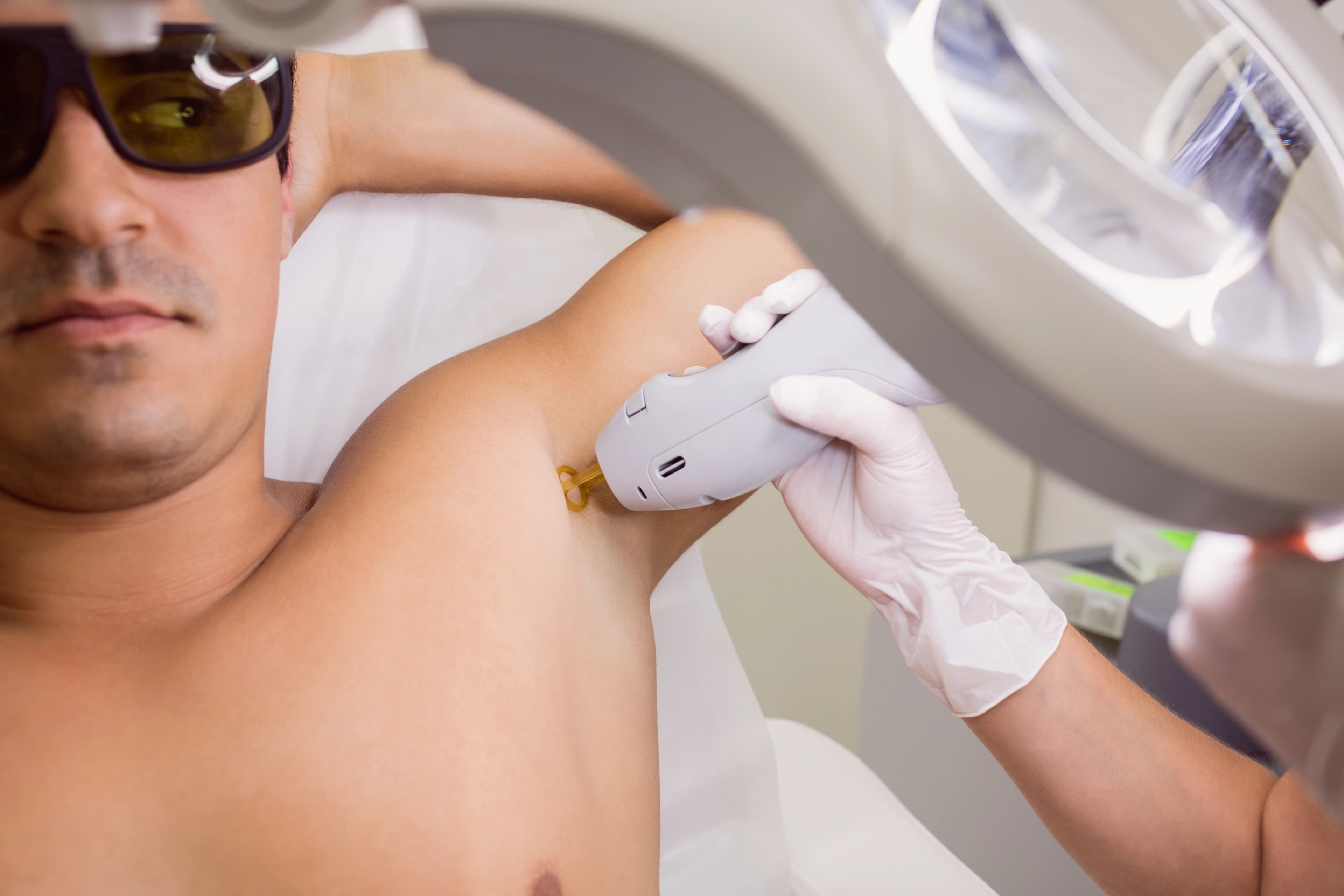 Male patient undergoing advanced laser hair reduction